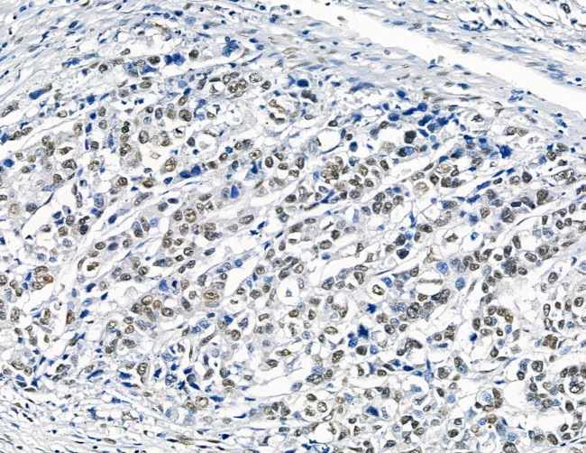 GTF2H4 Antibody in Immunohistochemistry (Paraffin) (IHC (P))