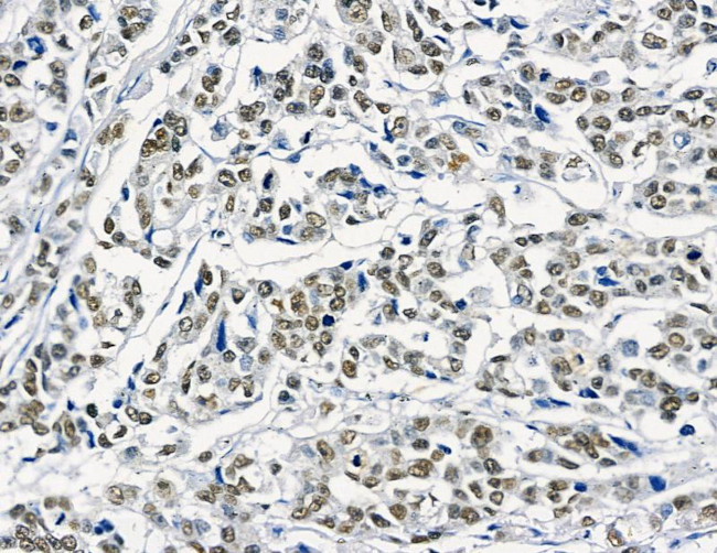 GTF2H4 Antibody in Immunohistochemistry (Paraffin) (IHC (P))