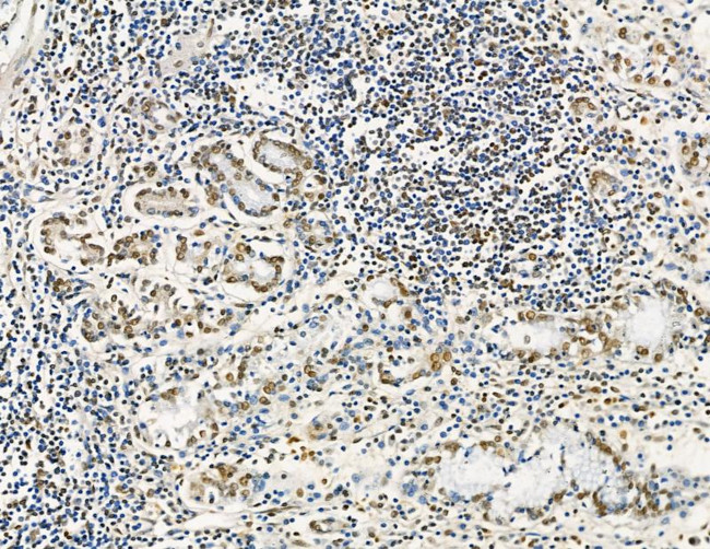 GTF2H4 Antibody in Immunohistochemistry (Paraffin) (IHC (P))