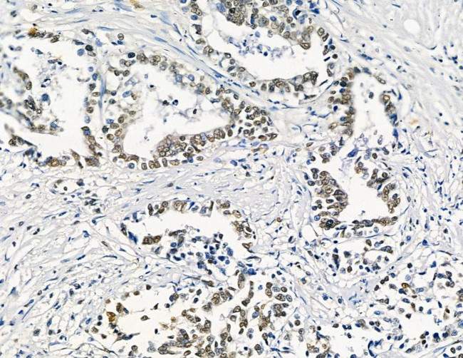 GTF2H4 Antibody in Immunohistochemistry (Paraffin) (IHC (P))