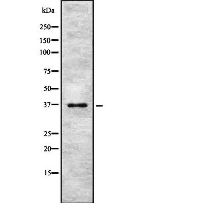 PINX1 Antibody in Western Blot (WB)