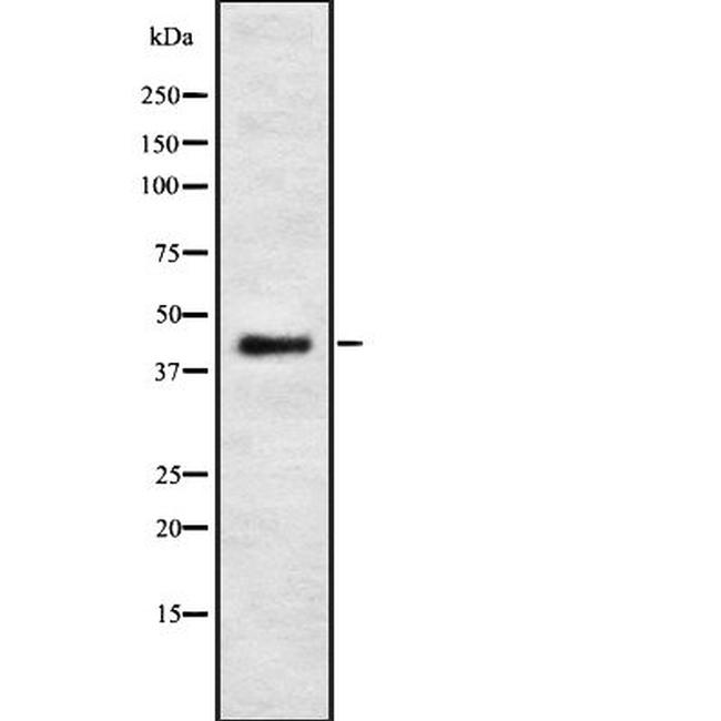 PSKH2 Antibody in Western Blot (WB)