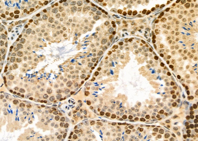 PKD1/2/3/PKC mu Antibody in Immunohistochemistry (Paraffin) (IHC (P))