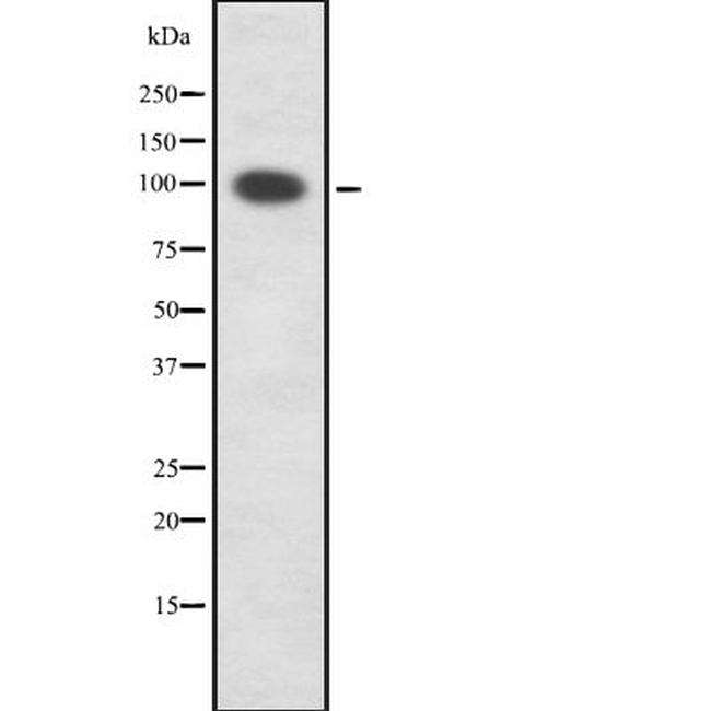 PKD1/2/3/PKC mu Antibody in Western Blot (WB)