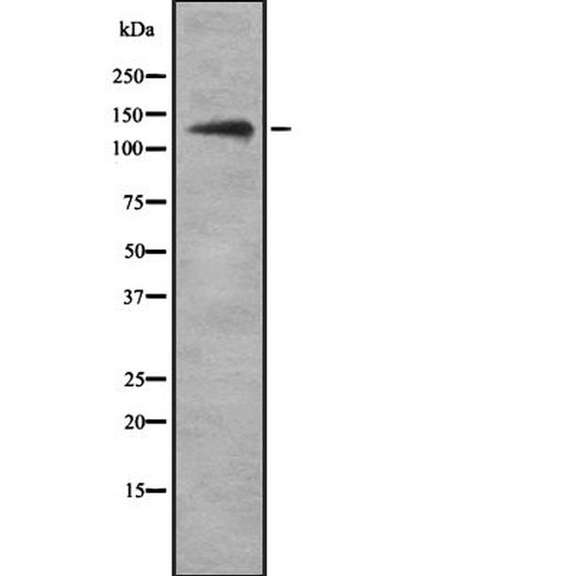 Ubinuclein 1 Antibody in Western Blot (WB)