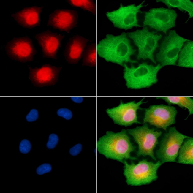 CHRAC1 Antibody in Immunocytochemistry (ICC/IF)