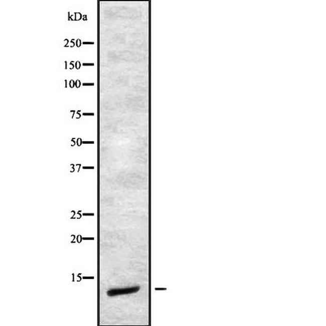 CHRAC1 Antibody in Western Blot (WB)