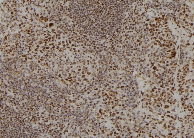 APOBEC3C Antibody in Immunohistochemistry (Paraffin) (IHC (P))