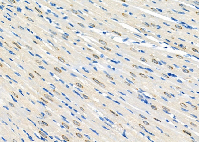 TRIM33 Antibody in Immunohistochemistry (Paraffin) (IHC (P))