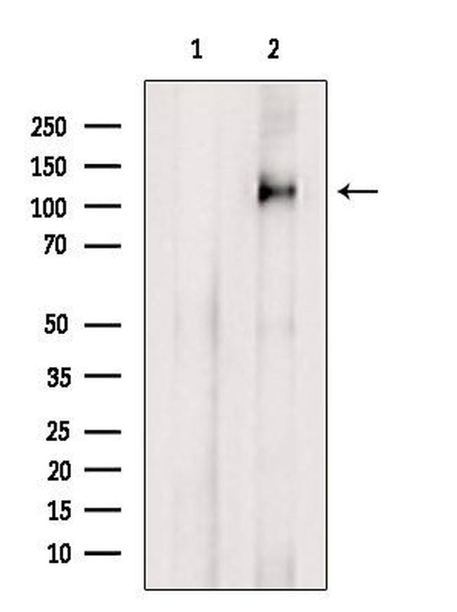 TRIM33 Antibody in Western Blot (WB)