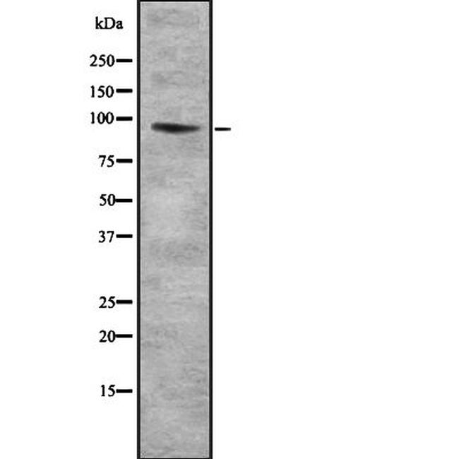 COL9A1 Antibody in Western Blot (WB)