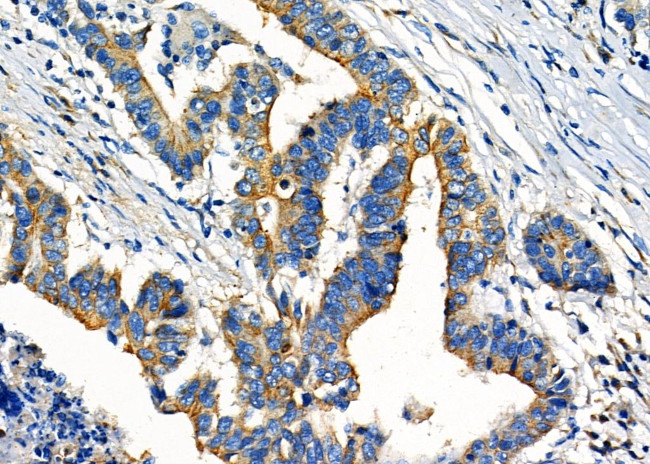 COX15 Antibody in Immunohistochemistry (Paraffin) (IHC (P))