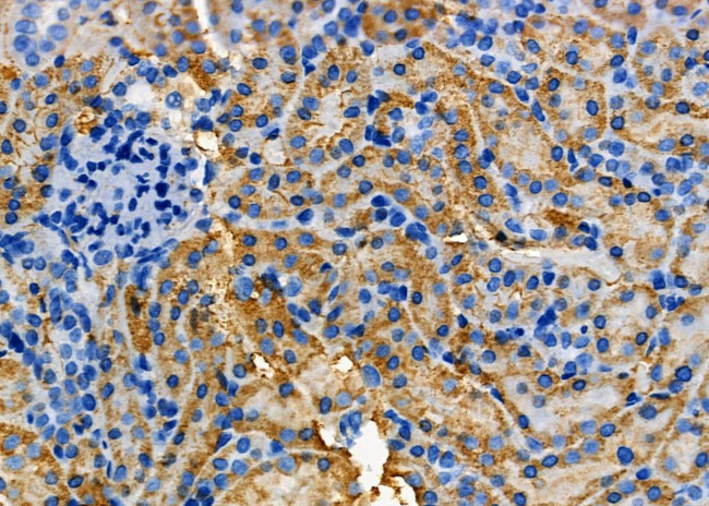 COX15 Antibody in Immunohistochemistry (Paraffin) (IHC (P))