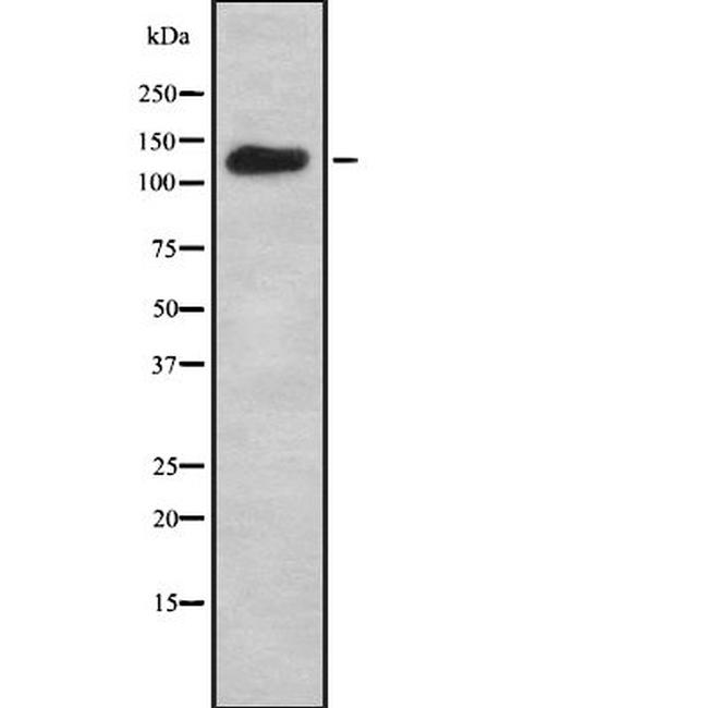 Adenylate Cyclase 7 Antibody in Western Blot (WB)