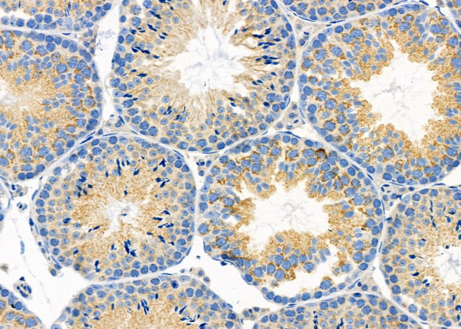 COX7C Antibody in Immunohistochemistry (Paraffin) (IHC (P))