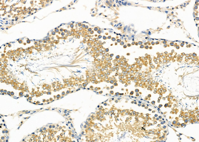 COX7C Antibody in Immunohistochemistry (Paraffin) (IHC (P))