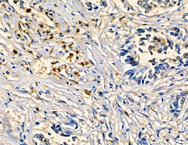 CYP4F3 Antibody in Immunohistochemistry (Paraffin) (IHC (P))