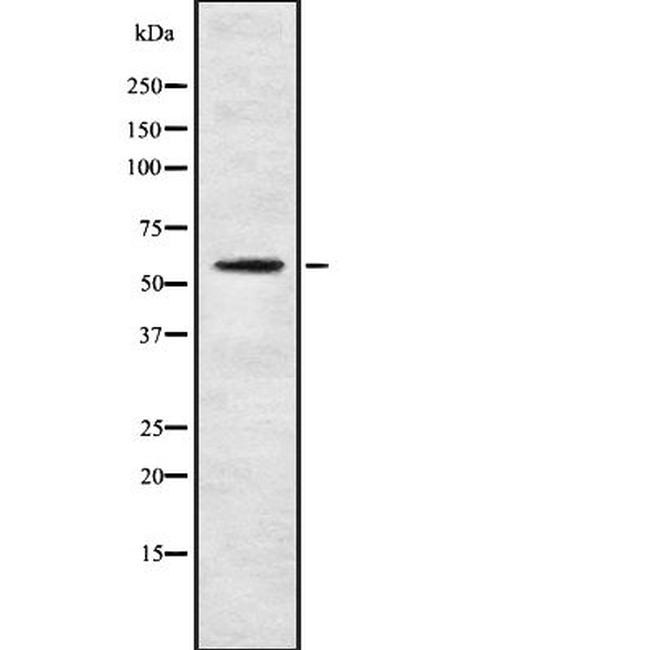 CYP4F3 Antibody in Western Blot (WB)