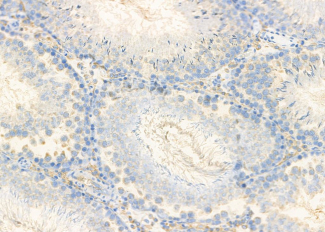 CALY Antibody in Immunohistochemistry (Paraffin) (IHC (P))