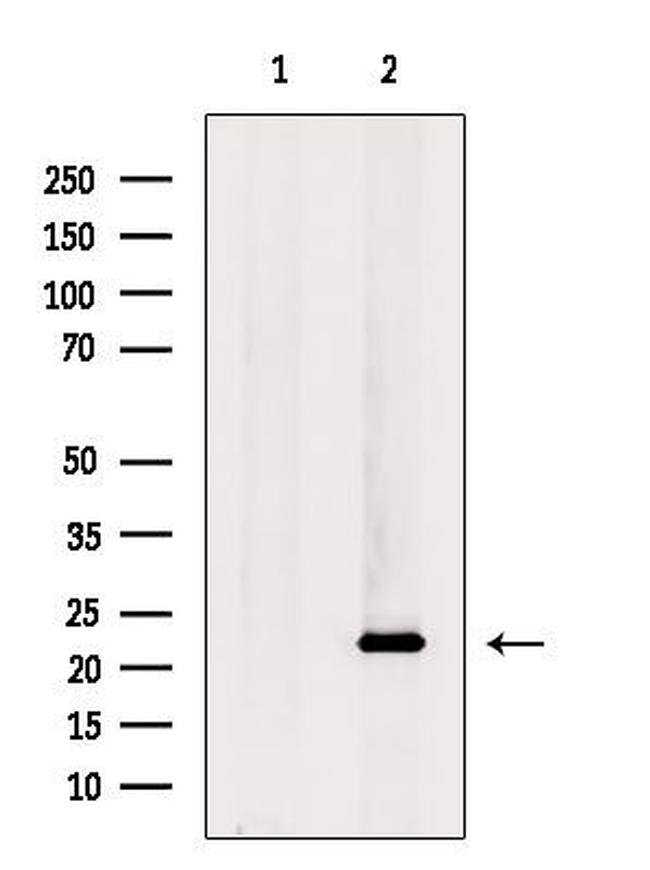 CALY Antibody in Western Blot (WB)