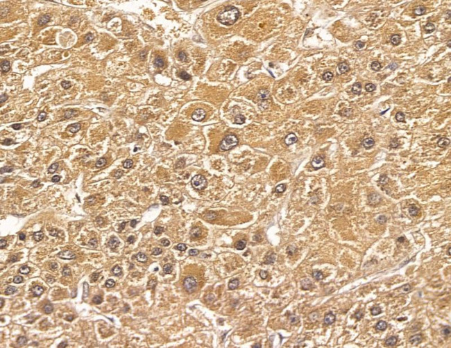 FGFBP3 Antibody in Immunohistochemistry (Paraffin) (IHC (P))