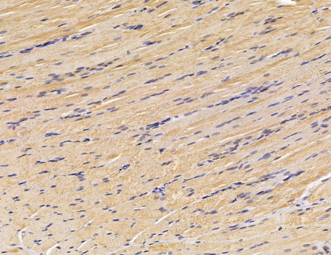 FGFBP3 Antibody in Immunohistochemistry (Paraffin) (IHC (P))