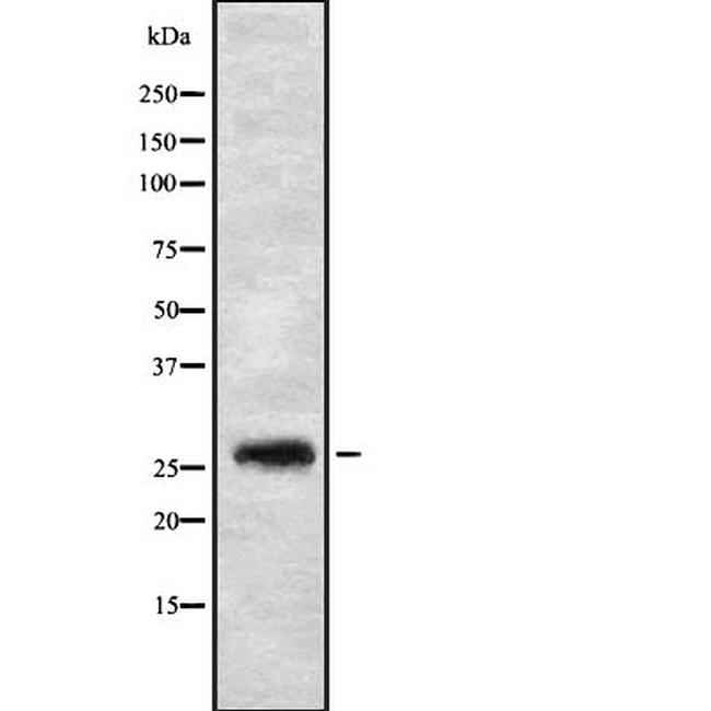 FGFBP3 Antibody in Western Blot (WB)