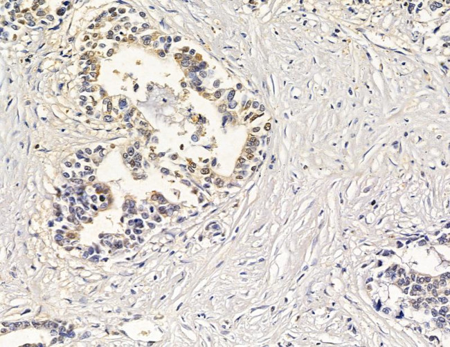 IFI44 Antibody in Immunohistochemistry (Paraffin) (IHC (P))