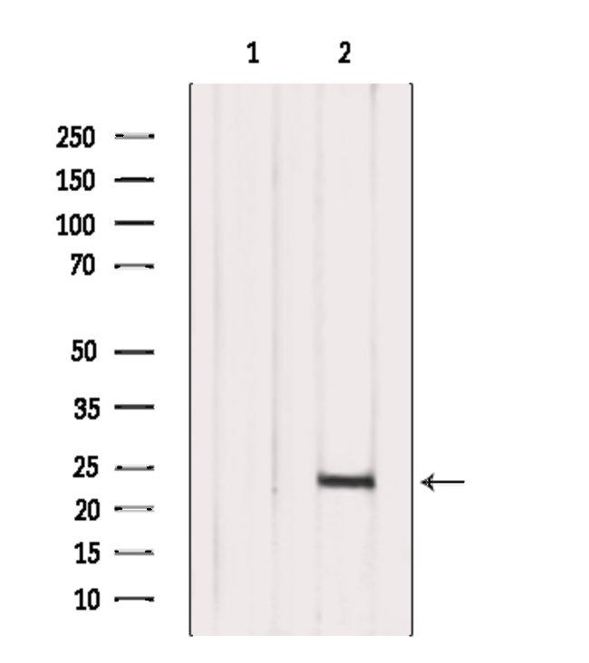 Interferon alpha-10 Antibody in Western Blot (WB)