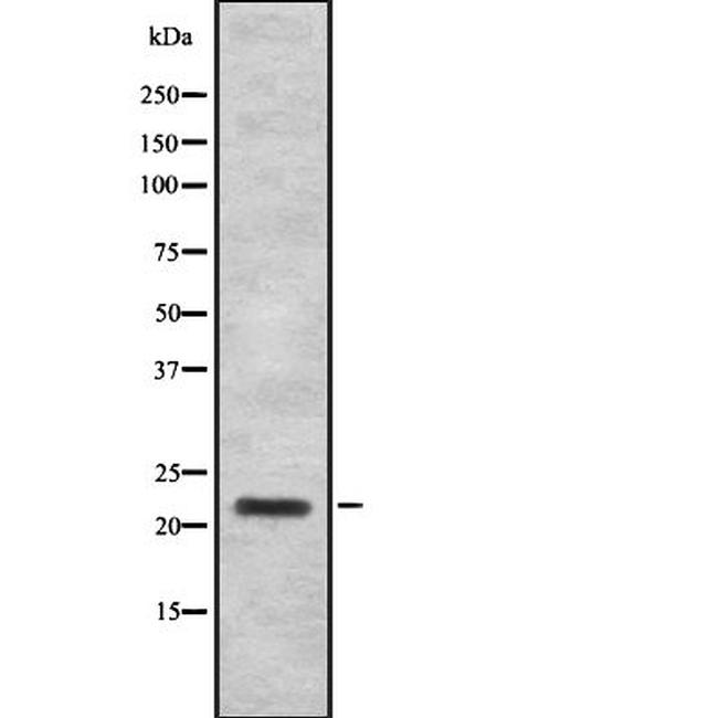 IFNA7/IFNA16 Antibody in Western Blot (WB)