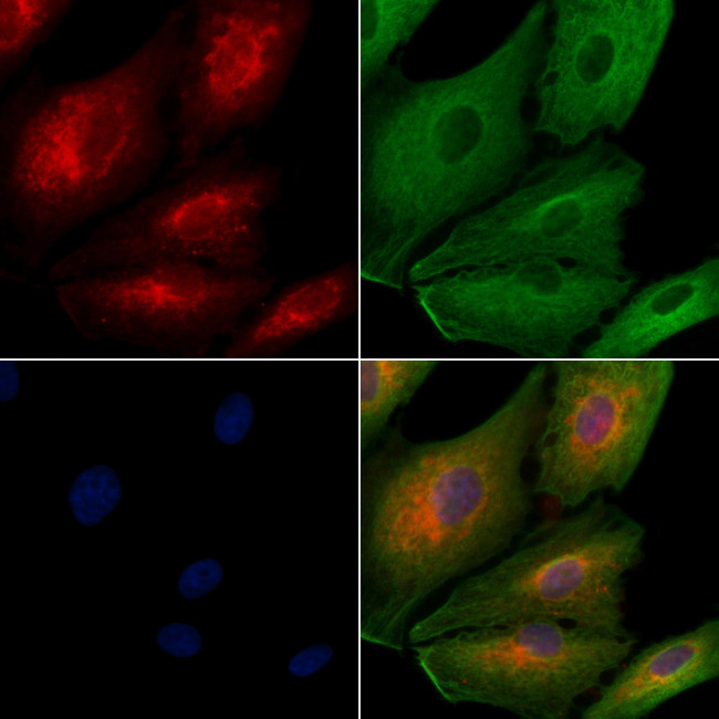 IFIT1B Antibody in Immunocytochemistry (ICC/IF)