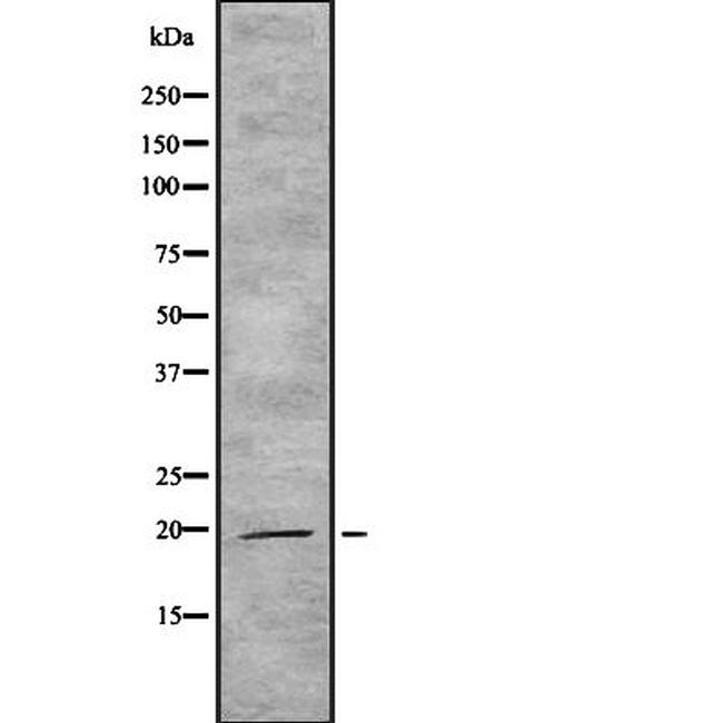 IL-19 Antibody in Western Blot (WB)