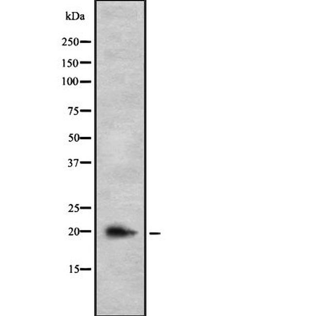 IL-26 Antibody in Western Blot (WB)