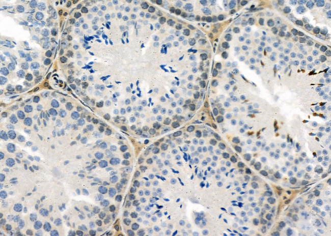 IFI27 Antibody in Immunohistochemistry (Paraffin) (IHC (P))