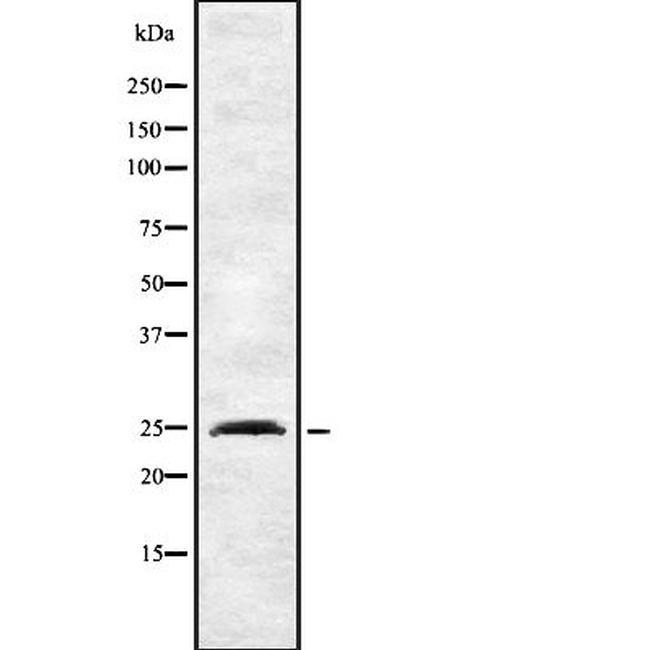 INSIG2 Antibody in Western Blot (WB)