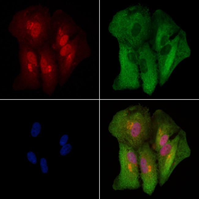 KRT9 Antibody in Immunocytochemistry (ICC/IF)