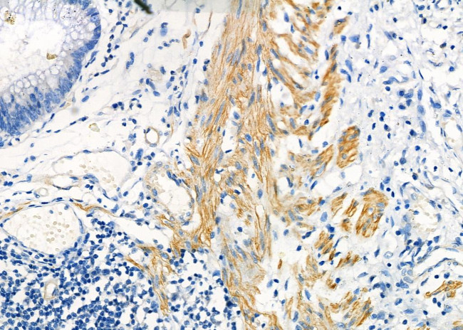 KRT9 Antibody in Immunohistochemistry (Paraffin) (IHC (P))