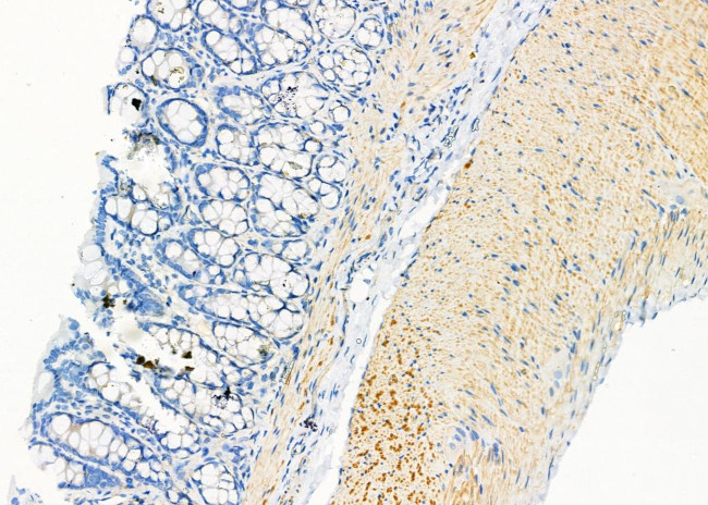 KRT9 Antibody in Immunohistochemistry (Paraffin) (IHC (P))