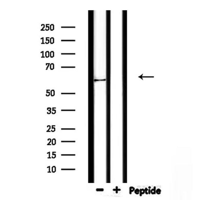 KRT9 Antibody in Western Blot (WB)