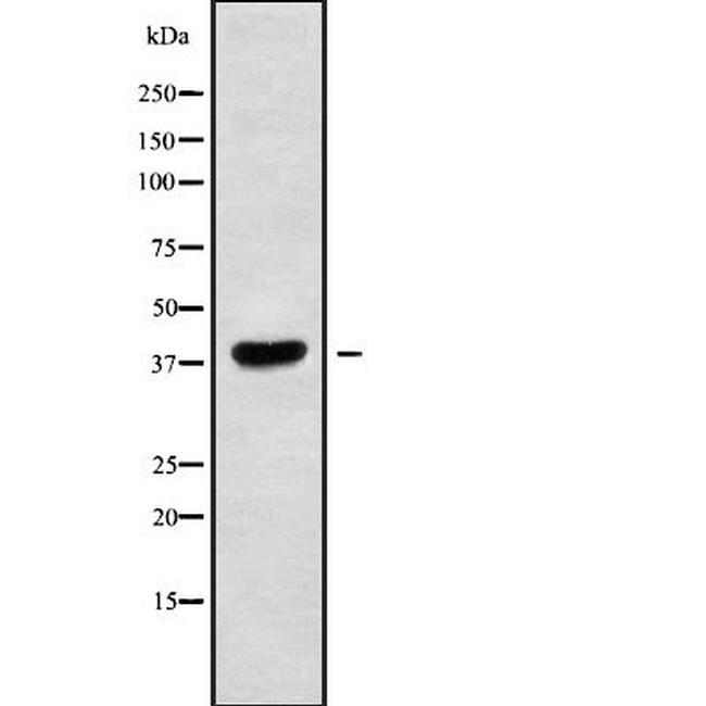 MAGEA10 Antibody in Western Blot (WB)