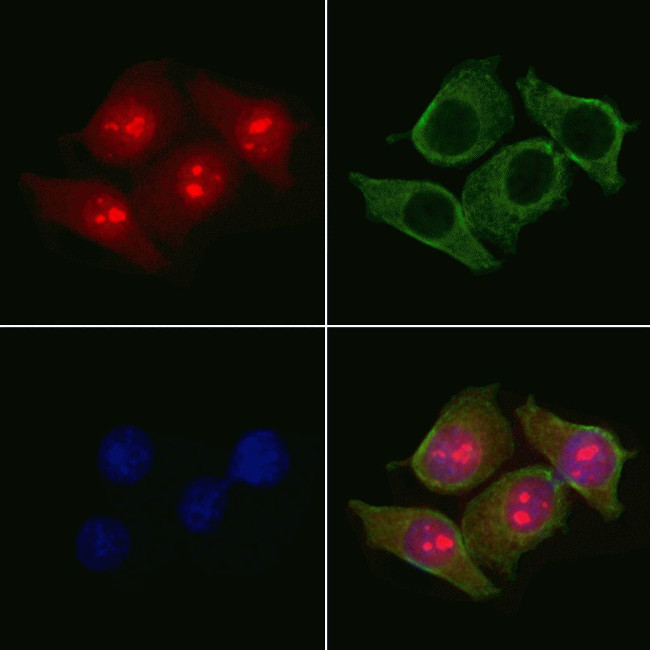 MAGEB4 Antibody in Immunocytochemistry (ICC/IF)