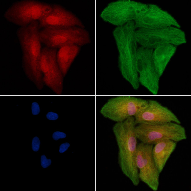 MAGEE1 Antibody in Immunocytochemistry (ICC/IF)