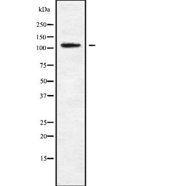 MAGEE1 Antibody in Western Blot (WB)