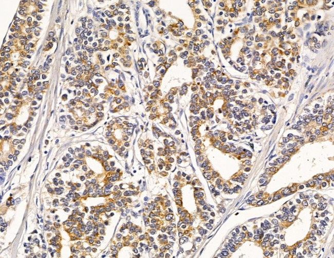 LAMTOR2 Antibody in Immunohistochemistry (Paraffin) (IHC (P))