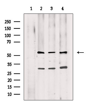 PDCD7 Antibody in Western Blot (WB)