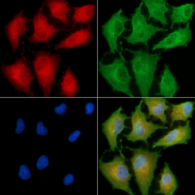 ALPPL2 Antibody in Immunocytochemistry (ICC/IF)