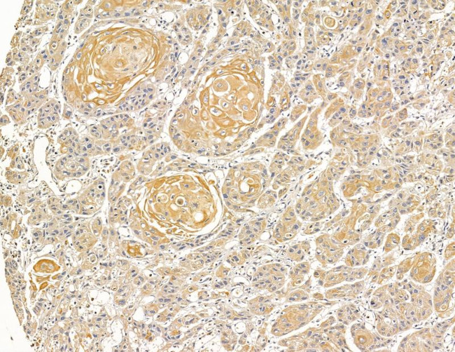 ALPPL2 Antibody in Immunohistochemistry (Paraffin) (IHC (P))