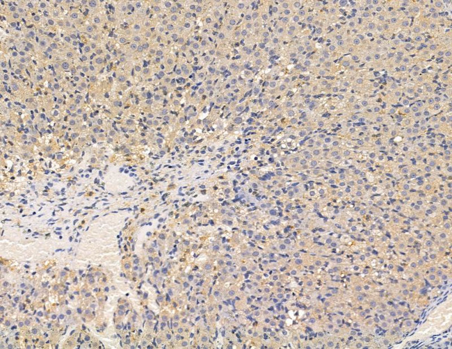 ALPPL2 Antibody in Immunohistochemistry (Paraffin) (IHC (P))