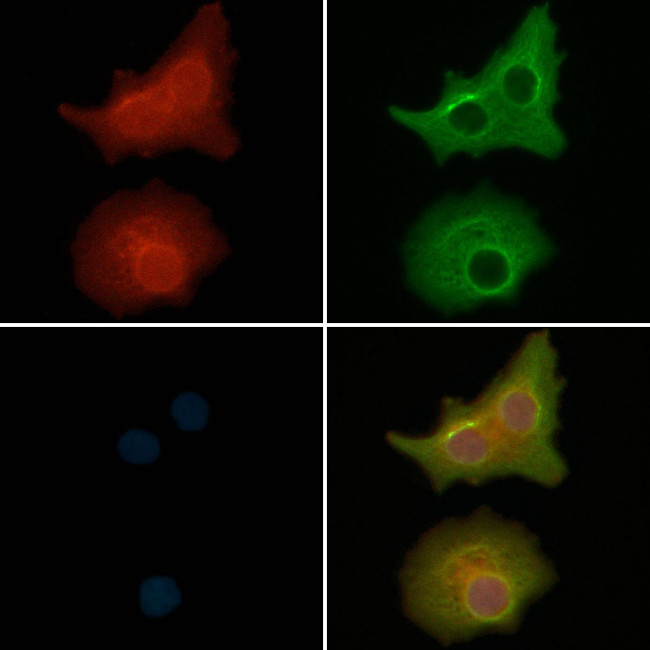 WNT7B Antibody in Immunocytochemistry (ICC/IF)