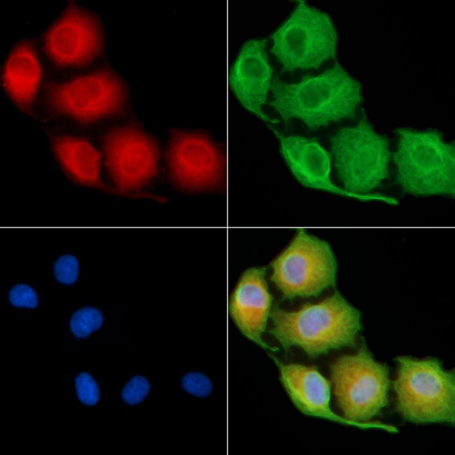 EDAR Antibody in Immunocytochemistry (ICC/IF)